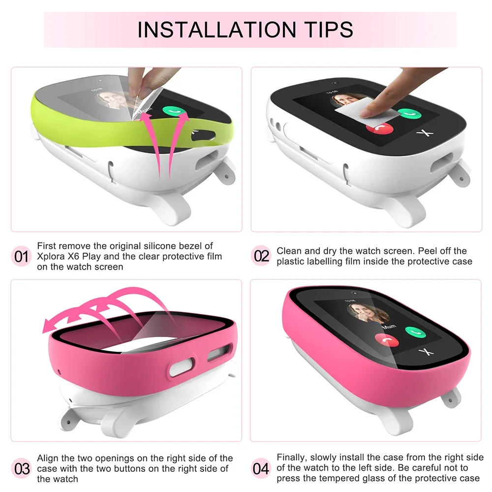 เคสสำหรับ xploar X6 Play อุปกร - Smartwatch Icon บทวิจารณ์และราคา